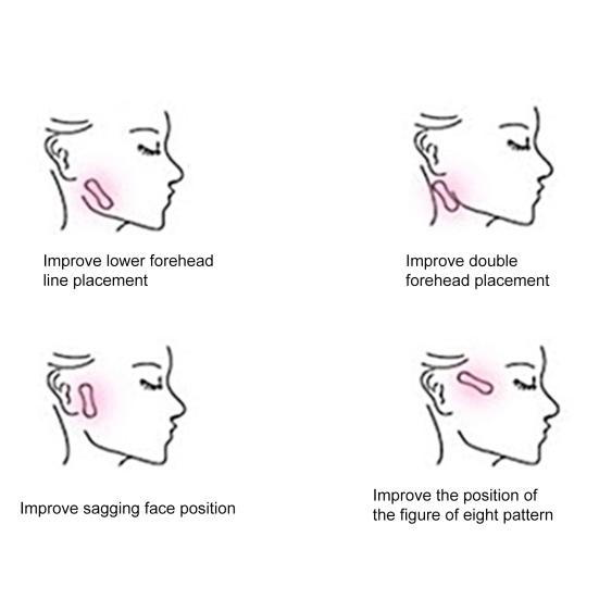 Yousheng 200 шт. укрепляющий пластырь для лица, простой в использовании, легкий, удобный, эффективный, против морщин, портативный, V-образный, невидимый пластырь для наружного применения