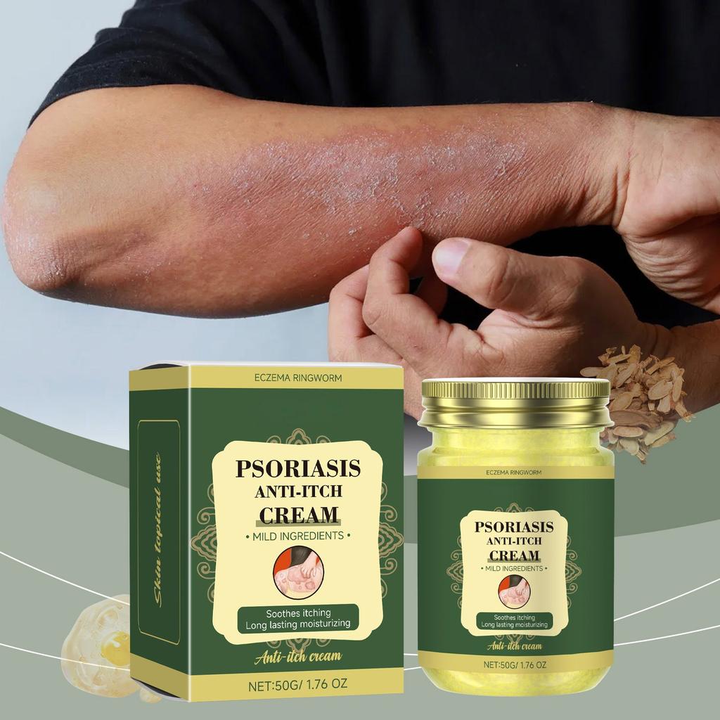 Восстанавливающий крем против зуда, крем для ухода за кожей, нежный травяной уход за кожей и телом, увлажняет и питает кожу, увлажняет