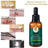 Hair Growth Essence, Hair Care Products, Hair Essence, Fast Hair Growth, Nourishing Hair, Moisturizing And Softening Hair Quality