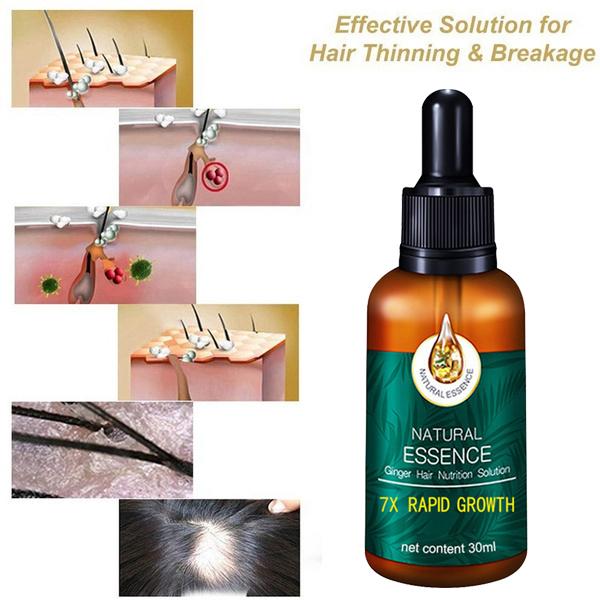 Hair Growth Essence, Hair Care Products, Hair Essence, Fast Hair Growth, Nourishing Hair, Moisturizing And Softening Hair Quality