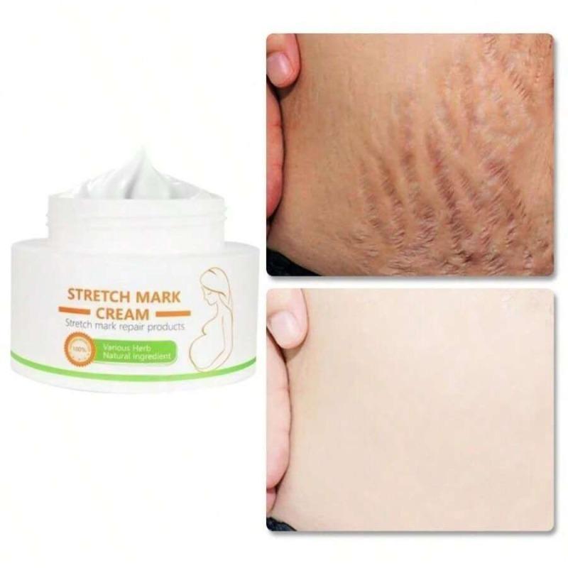 Лучший органический восстанавливающий крем от шрамов, натуральный крем для удаления целлюлита, против растяжек при беременности, крем для женщин