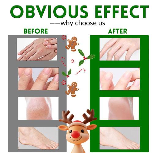 Christmas Gift: Moisturizing Foot and Hand Masks, 12-Count, Gloves & Socks Included. Intensive Repair Mask, Peeling Mask for Women, Dry and Cracked Sk