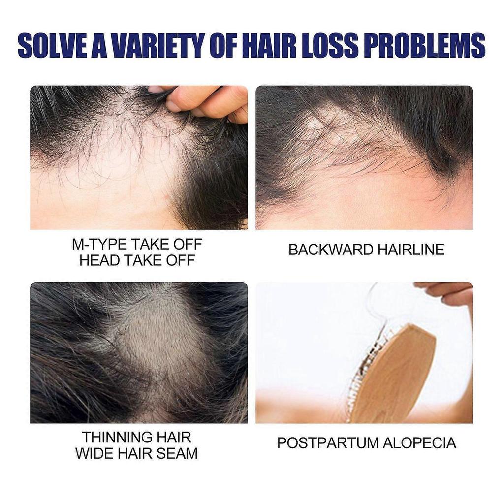 East Moon Men's Hair Thickening Foam - Repairs Hair Follicles, Makes Hair Thicker And Nourished