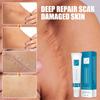 20g Scar Repair Cream Naturally Fade Stretch Marks and Scalded Skin Surgical Scar Repair Cream