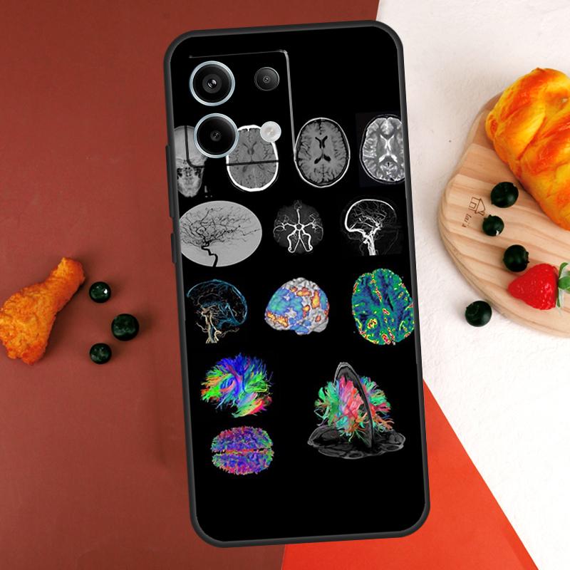 Чехол Anatomy Brain для Xiaomi Redmi Note 13 14 Pro 9 10 11 12 Pro 10S 11S 12S Redmi 13C 10C 12C 14C Coque