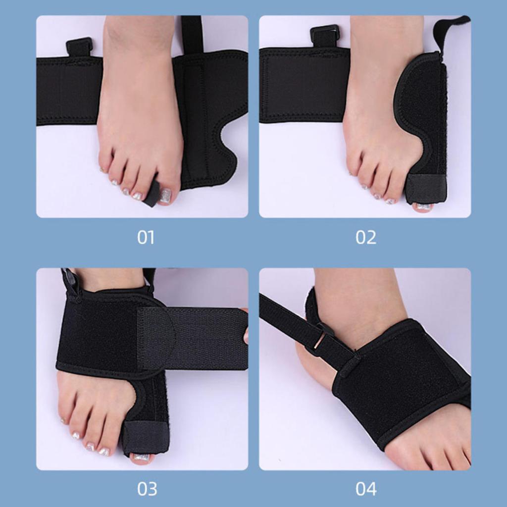 Корректор для пальцев ног Ортопедические изделия Корректор косточки большого пальца Молоточкообразный палец Протектор Hallux Valgus Бандаж Корректор косточки Ортопедический инструмент Инструменты для ухода