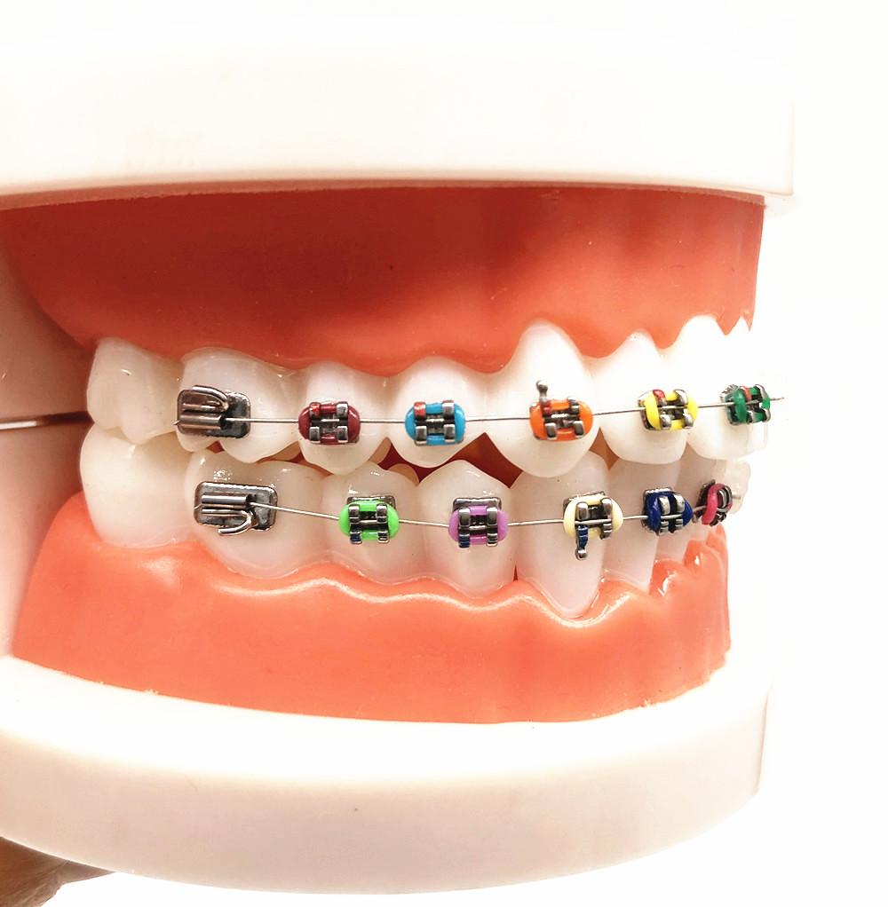 1 шт., стоматологическая модель для ухода за полостью рта, стоматологическая ортодонтическая модель для общения с пациентом, модель для исследования стоматолога