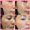 RXDerma EGF Cica Regen Secolgy Cream Керамиды Пантенол Центелла азиатская Дерматология Восстанавливающий успокаивающий крем после лазера, 50 мл, 1 шт.