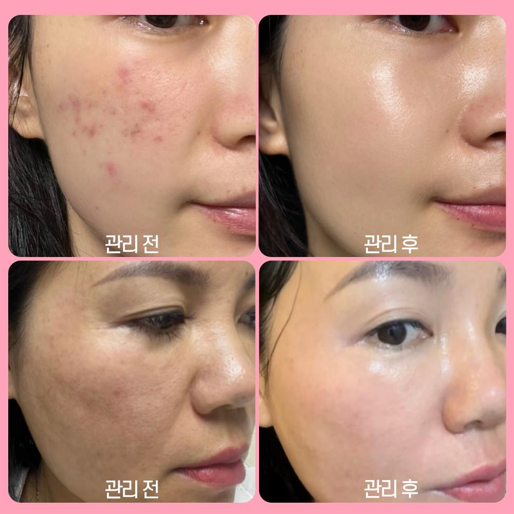 RXDerma EGF Cica Regen Secolgy Cream Керамиды Пантенол Центелла азиатская Дерматология Восстанавливающий успокаивающий крем после лазера, 50 мл, 1 шт.