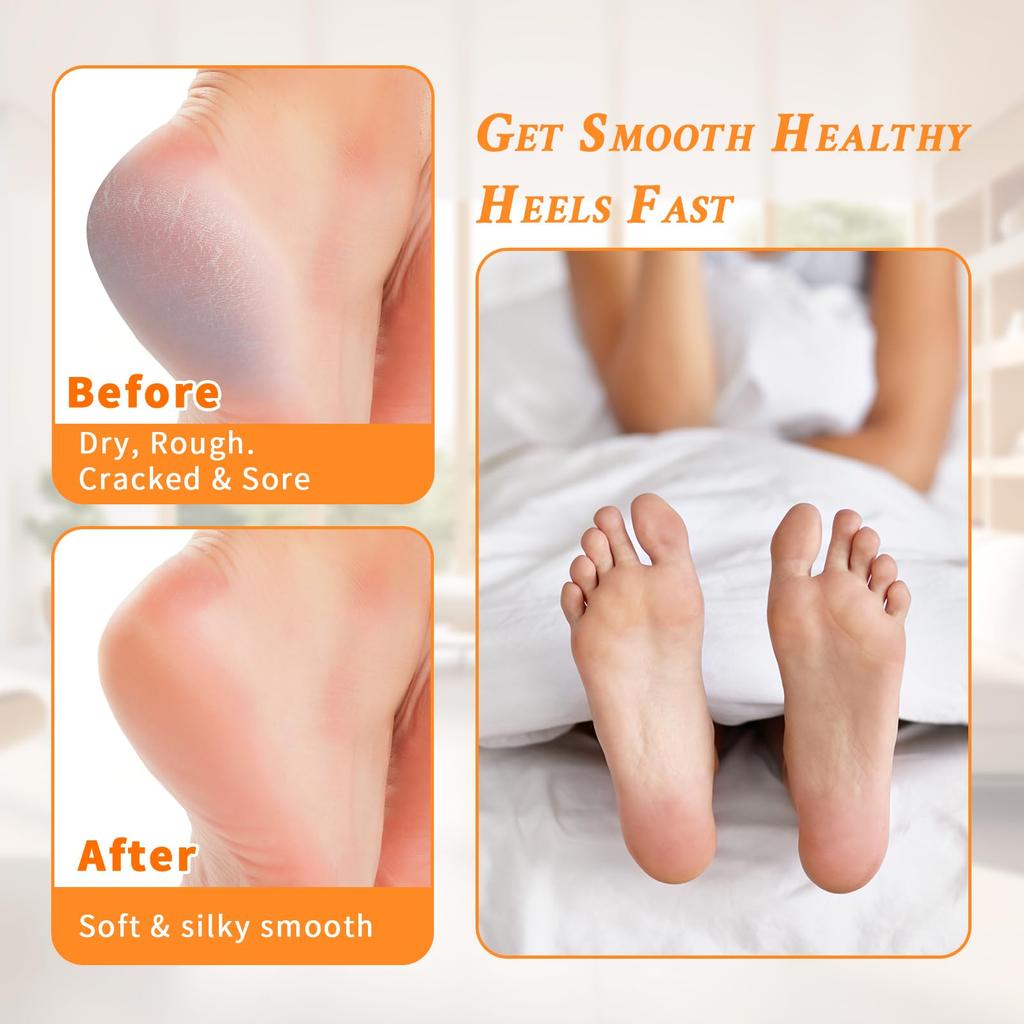 Силиконовые носки для пяток для мужчин и женщин, противотрещинные увлажняющие носки, протектор для облегчения боли в пятке, рукав для ухода за ногами