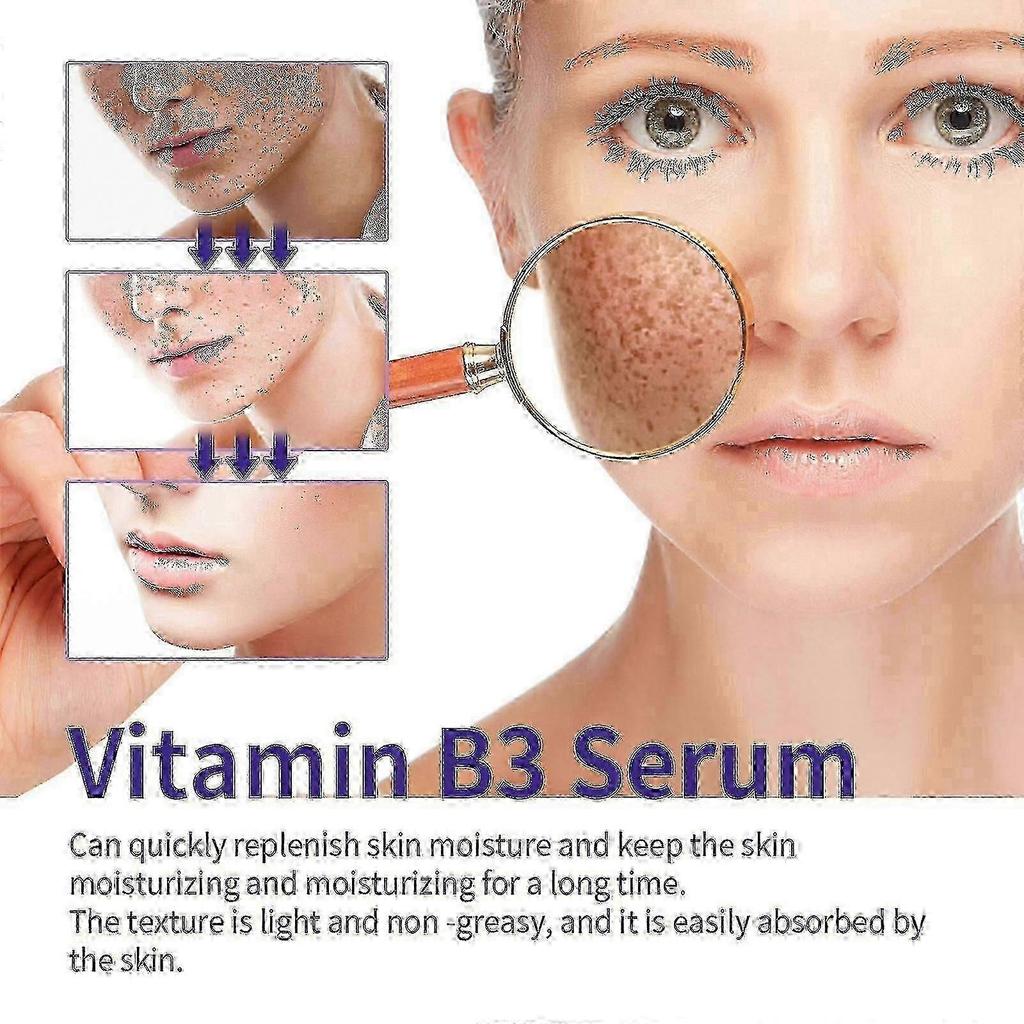 B3 Serum, Dark Spot Corrector B3 Serum With Anti-Aging 10% Niacinamide Discoloration Correcting Serum for Sun Spots, Age Spots
