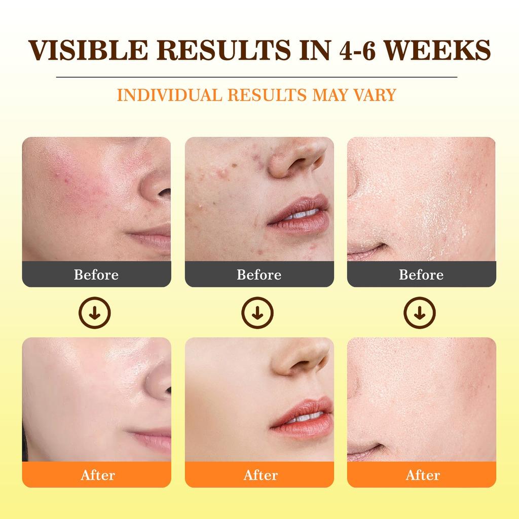 Очищающие диски, очищающие диски Kojic помогают сбалансировать жир и воду кожи, увлажняют, удаляют излишки кератина с кожи тела, 50 шт. /20 мл