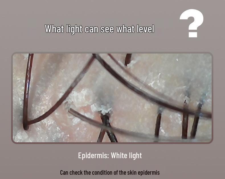 Смарт-детектор кожи головы и кожи высокой четкости с анализом волосяных фолликулов