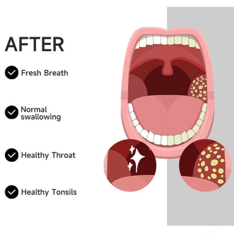 Электрический вакуумный удалитель миндалин, ручной набор для удаления миндалин, инструмент для чистки полости рта
