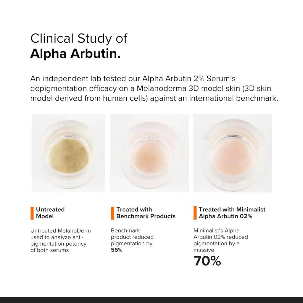 Minimalist Сыворотка для удаления пигментных пятен 2% альфа-арбутин при гиперпигментации, веснушках, следах от акне и загаре, некомедогенная, без отдушек, 10 мл