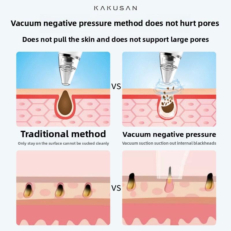 Зарядка Маленький Пузырь Удалитель Черных Точек Ультрамикро Домашняя Красота Сужение Пор Очистка Акне Удаление Черных Точек
