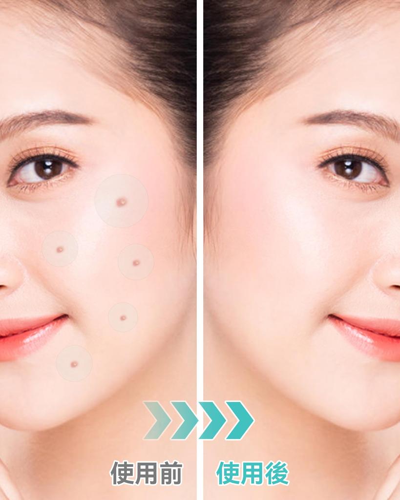 FERNIDA Spot 6 300 Pimple Skin Cute Spot Conceal Facial Makeup Large Tea Tree Star Shape Round Patches, Bulk, Colors, Patches, Care, Packs, Blemishes,