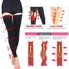 1Pair Medical Thigh High Compression Stockings Open Toe Compression Brace Wrap  Women