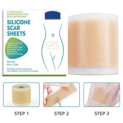 150/300 см силиконовый гелевый пластырь для лечения шрамов лента для удаления акне травма ожог шрам покрытие восстановление кожи раздел ухо красота