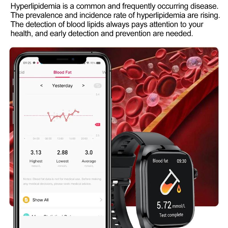 2025 Новые Точные Смарт-часы для Измерения Жира в Крови и Мочевой Кислоты Мужские Микрофизическое Обследование Здоровье Пяти Органов Часы Bluetooth Звонок Смарт-часы
