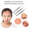 1 Pc Blackhead Tweezers Blackhead&Blemish Removers Point Bend Gib Head Comedone Acne Extractor Face Skin Care Tools