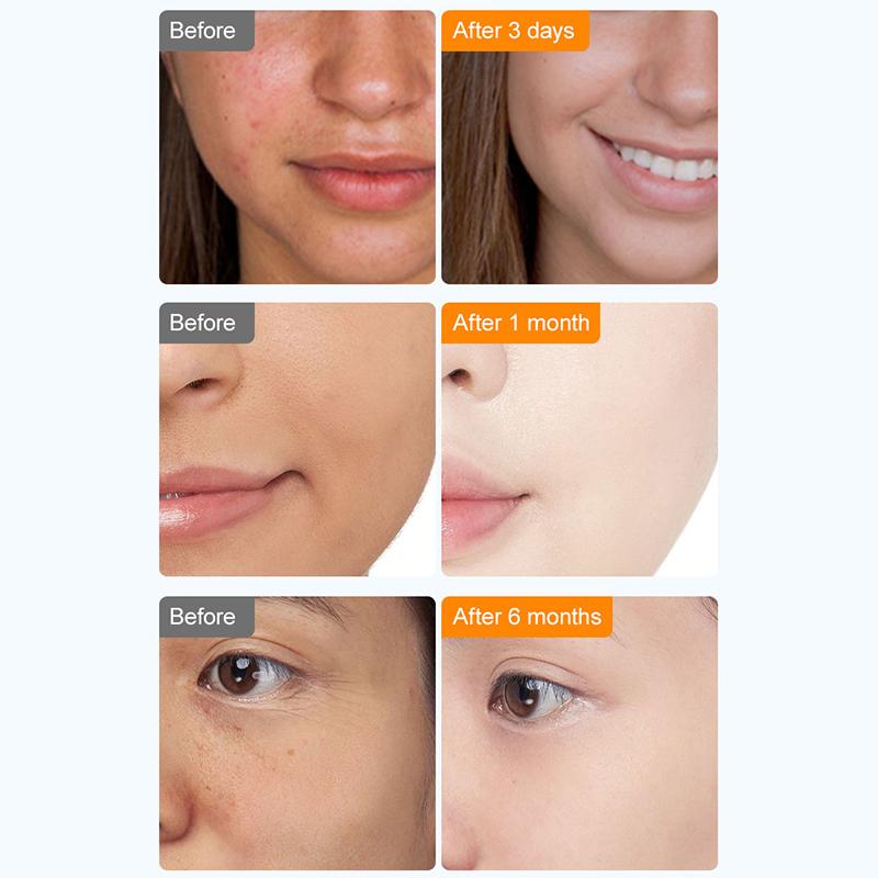 Солнцезащитный крем SPF 50 2023, солнцезащитный крем для лица, увлажняющий, осветляющий, отбеливающий солнцезащитный крем для тела, уход за кожей лица