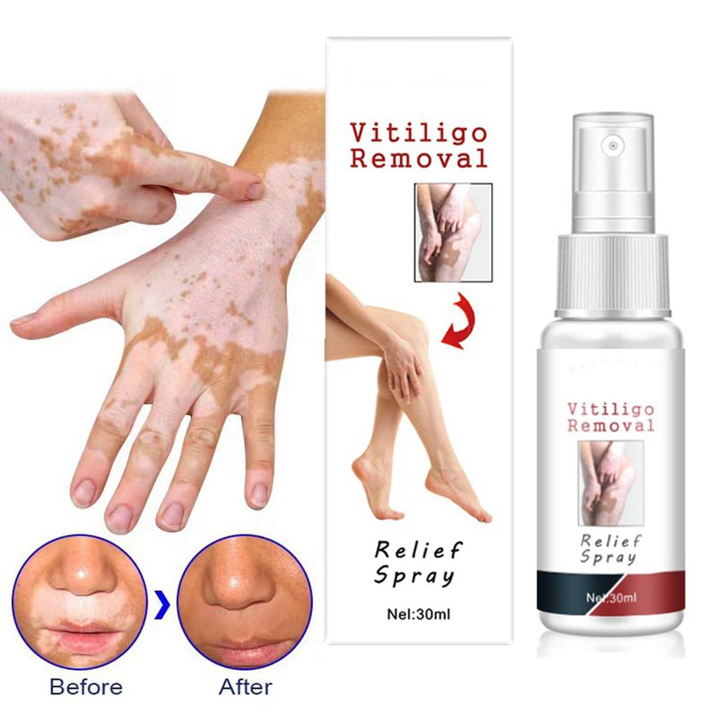 30 мл Белый очищающий спрей Psoralea Corylifolia Белый очищающий спрей Жидкий уход за кожей