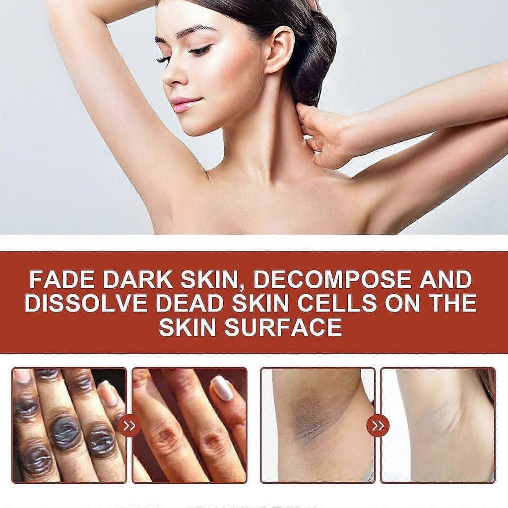 Eelhoe Acanthosis Nigricans Exfoliating Oil Brightens And Brightens The Complexion Of Armpits And Joints, Cleanses And Moisturizes The Skin