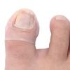 Силиконовый инструмент для коррекции вросших ногтей на ногах Невидимый уход за вросшими ногтями