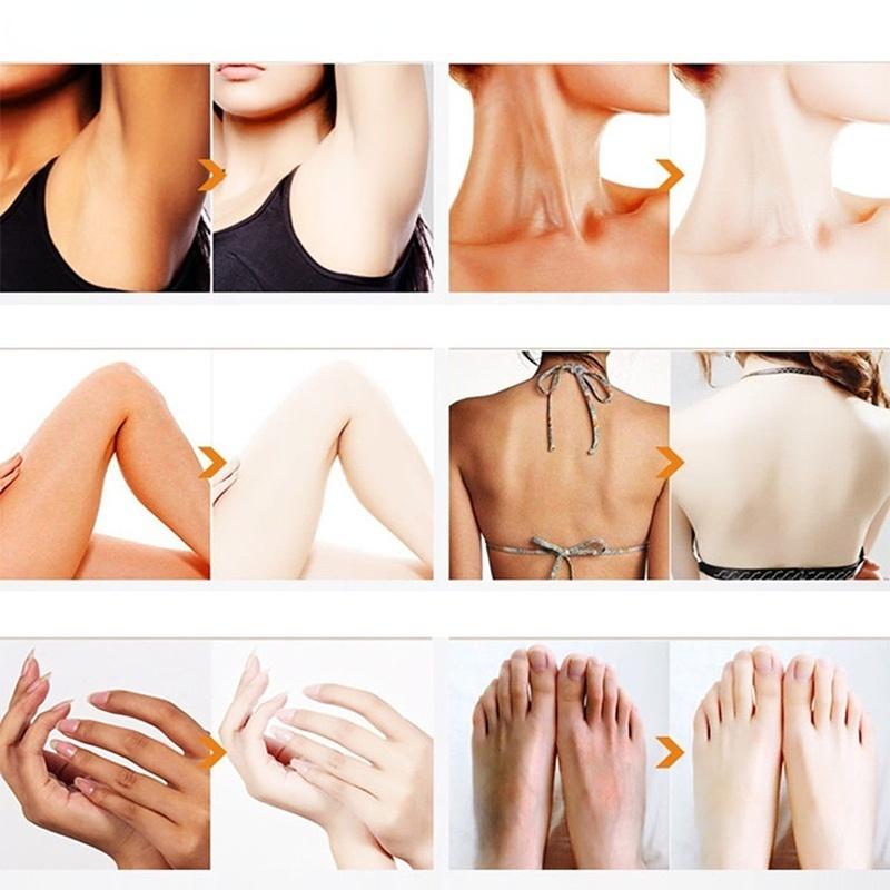 Отбеливающий крем для тела Крем для лица Удаляет мелазму, веснушки, возрастные пятна Регулирует регенерацию клеток кожи Изысканный смягчающий отбеливающий крем