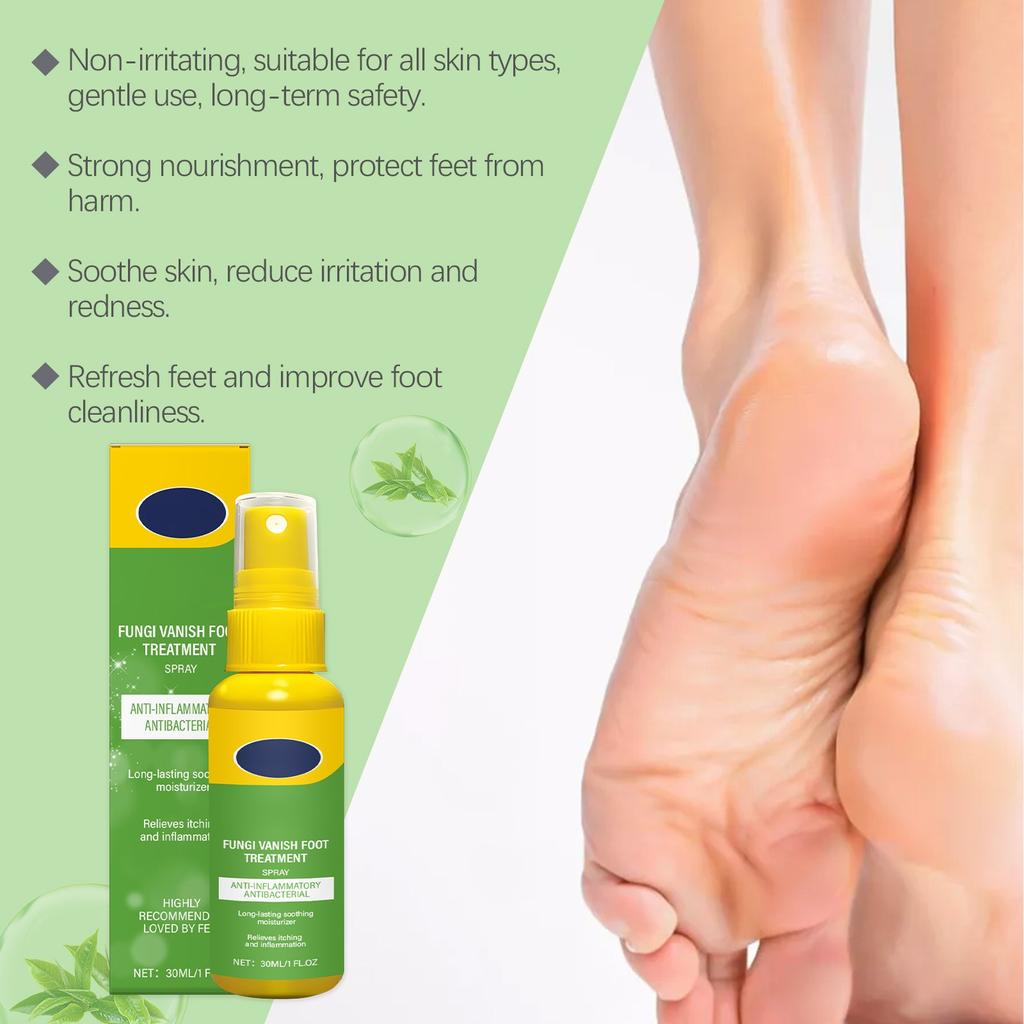 Foot Odor SprayAntibacterial Deodorant PowderAnti Itch Sweat Odor Feet Athletes Foot Liquid Anti-Fungi Shoe Sock Feet Care 30ml