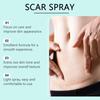 Спрей для удаления шрамов Спрей для ухода за кожей Спрей для ухода за кожей с мягкими ингредиентами, 50 мл