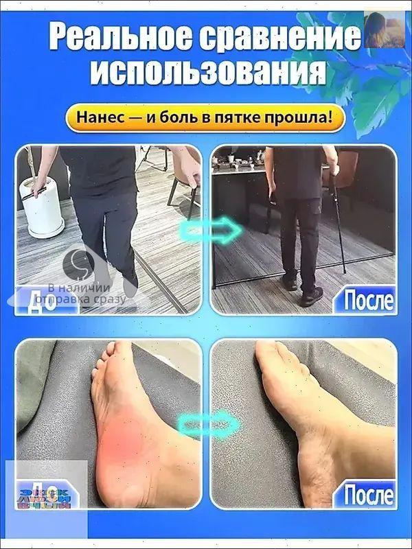 Медицинская желчь для пяточной шпоры жидкая 51 г