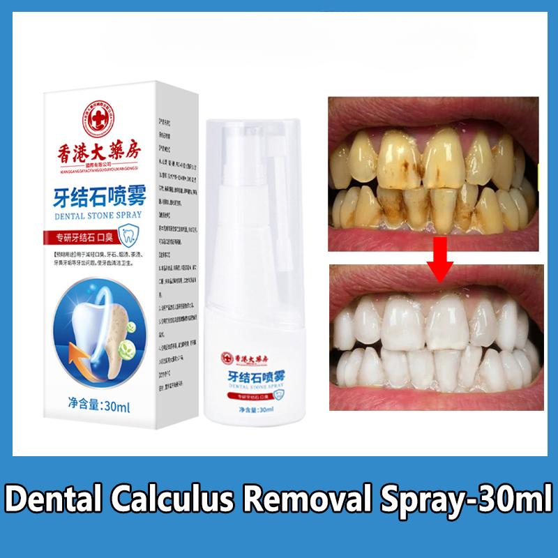 Спрей для удаления зубного камня для отбеливания зубов и удаления зубного налета