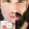 MEIYANQIONG 100% Natural Beard Dye Cream Men Mustache Beard Cream Natural Beard Care