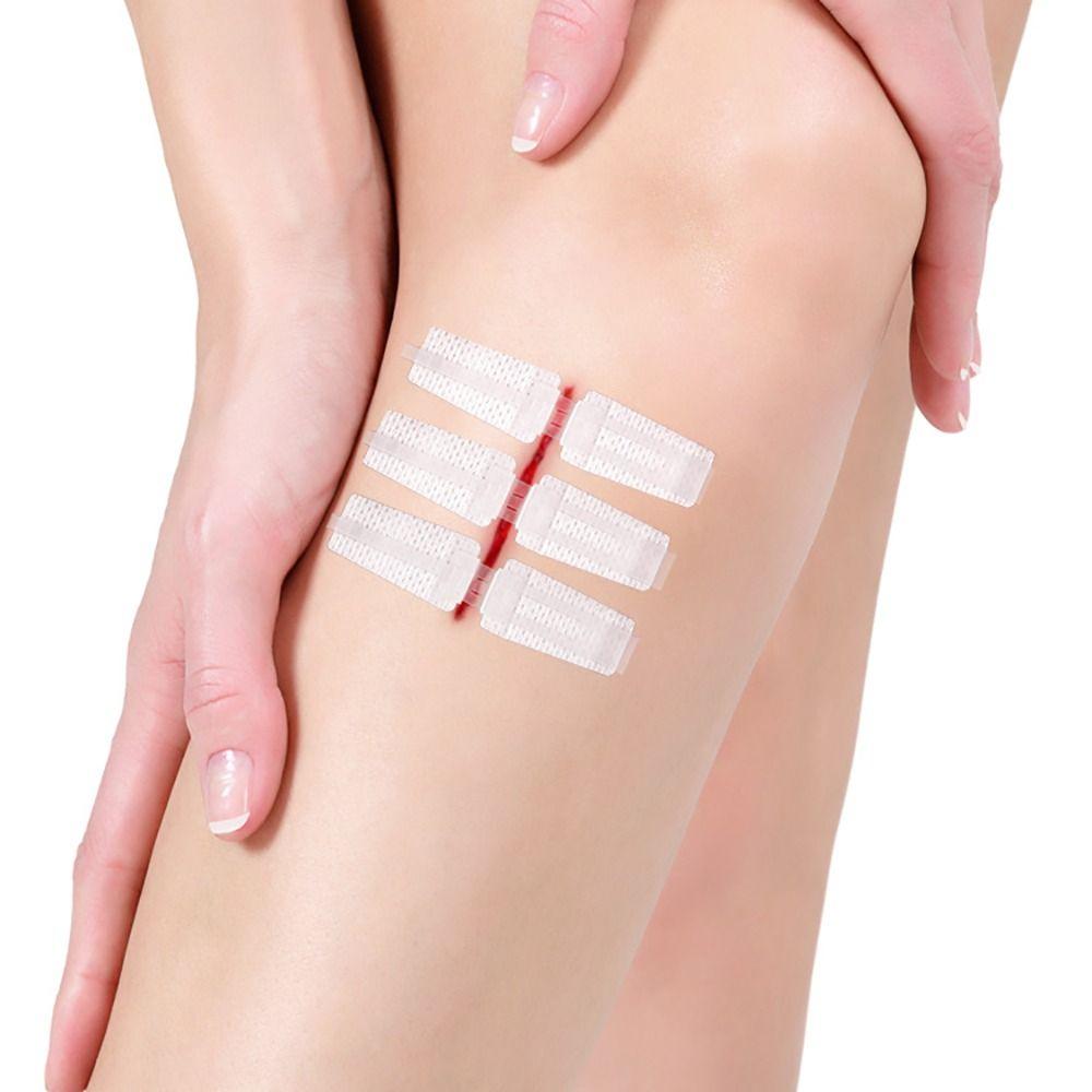 Первая помощь Экстренное закрытие ран без швов Ремонт разрывов застежкой-молнией Швы-молнии Пластыри