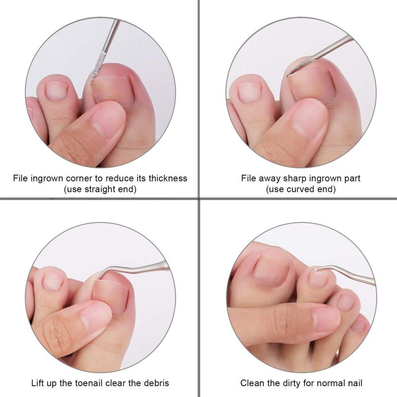 Щипчики для ногтей на ногах для вросших или толстых ногтей на ногах, триммер для ногтей на ногах, профессиональный ортопед, щипчики для ногтей на ногах с нержавеющей сталью