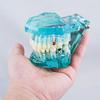 Dental Study Tooth Transparent Adult Pathological Teeth Model