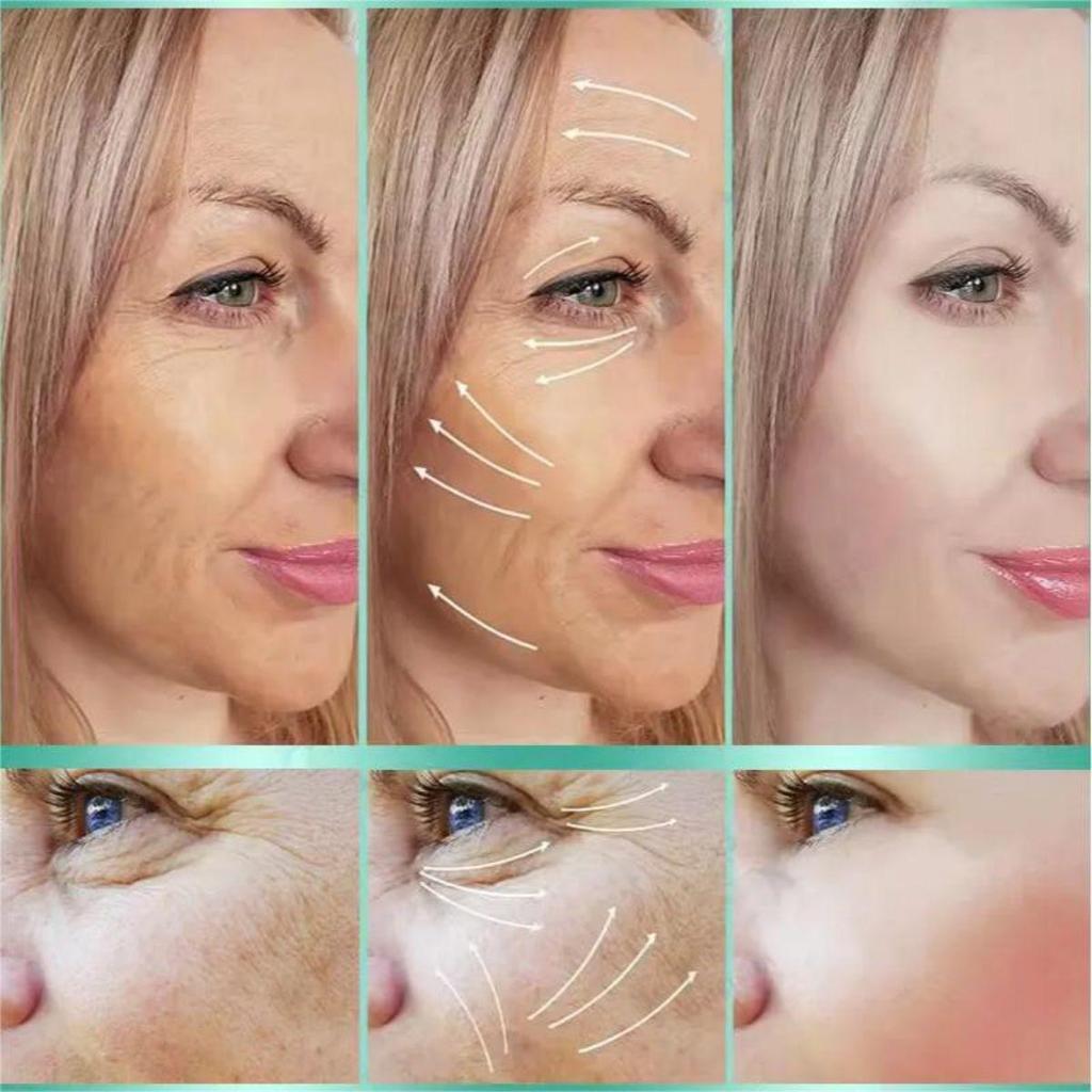 Осветляющий антивозрастной крем, замедляет потерю коллагена, омолаживает кожу, уменьшает морщины и борется со старением