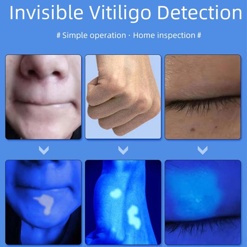 Лампа Вуда Ультрафиолетовый УФ Инструмент для Анализа Кожи Персональный Уход за Красотой Уход за Кожей Увеличительный Анализатор для Ежедневного Использования в Красоте