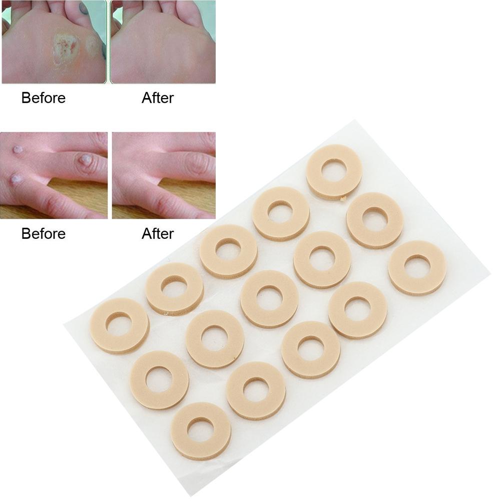 15 шт пластырь для удаления мозолей на ногах, облегчение боли в ногах, уход за здоровьем ног