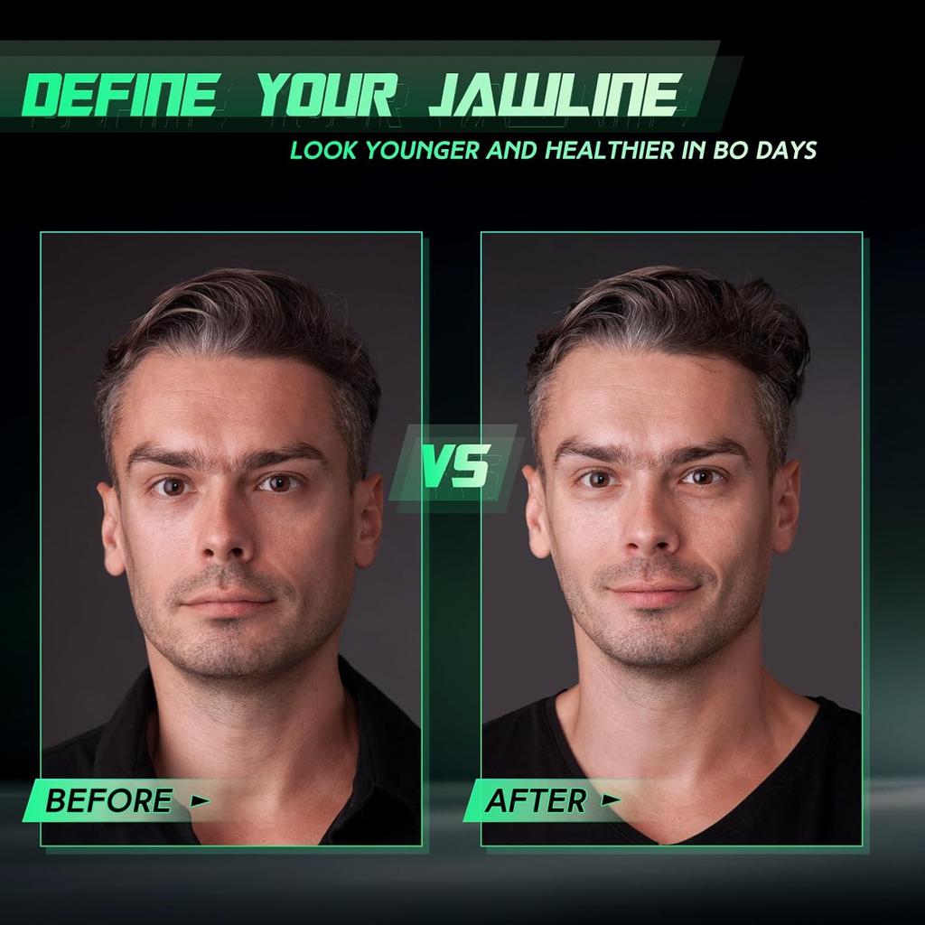 Тренажер для линии челюсти для мужчин и женщин – Тренажер для челюсти – 3 уровня сопротивления Силиконовый тренажер для лица – Мощный тренажер для челюсти для начинающих