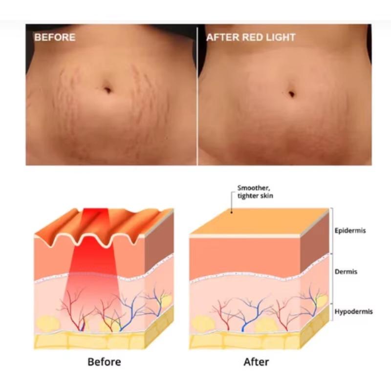 150W Infrared Heat Lamp Therapy Light - 360° Adjustable Clamp E27 Bulb for Muscle Pain Relief Home Physical Therapy