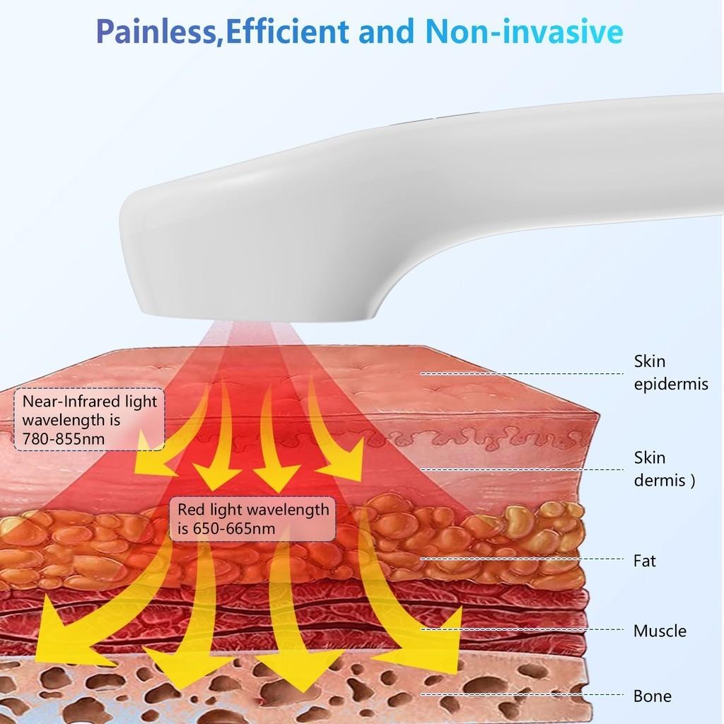 Физиотерапевтический прибор Низкоинтенсивный Холодный Лазерный Аппарат для Облегчения Боли Портативный Артрит Шейная Боль Боль в Плече