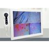 HD Digital Skin Analyzer Professional Hair Scalp Camera Detector Hair Follicle Oil Moisture Test Device 15inch