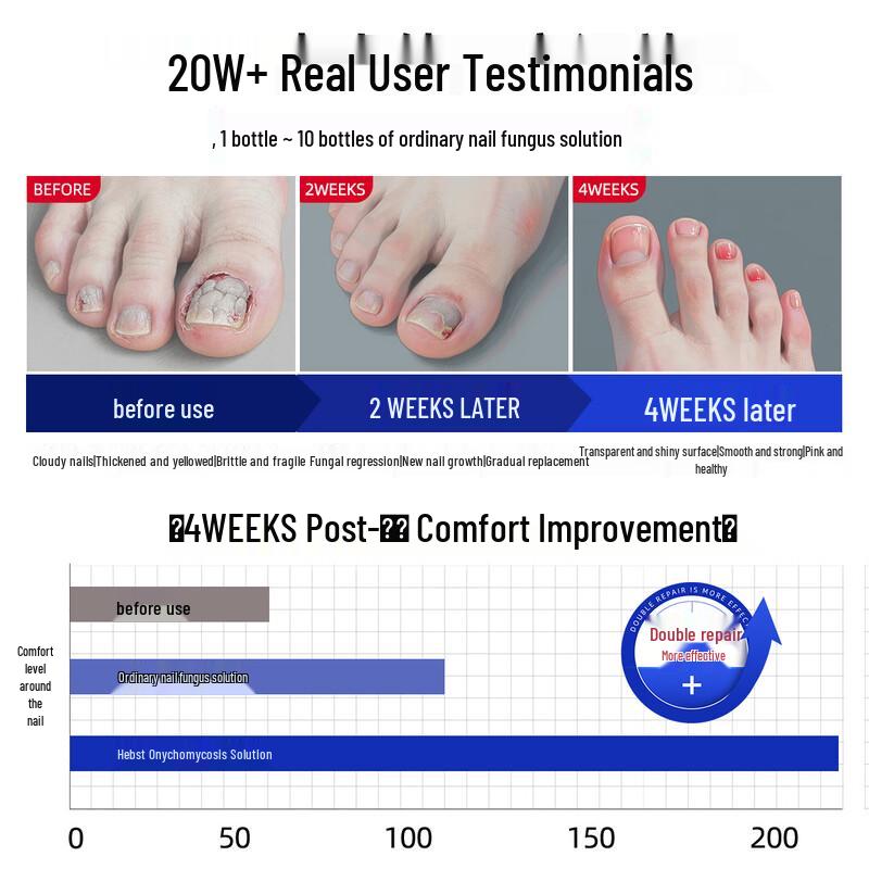 HEBST Toenail Fungus Treatment Liquid