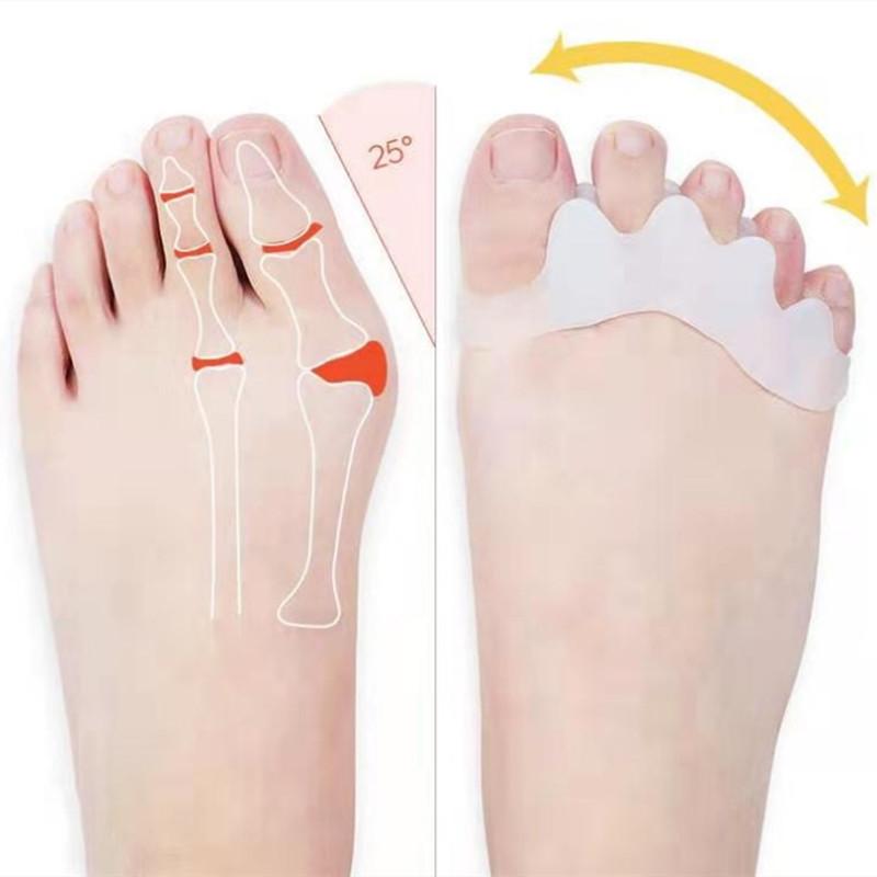 1 пара корректор-разделитель пальцев ног, мягкий силиконовый выпрямитель для педикюра, корректор костей ног, инструменты для ухода за ногами