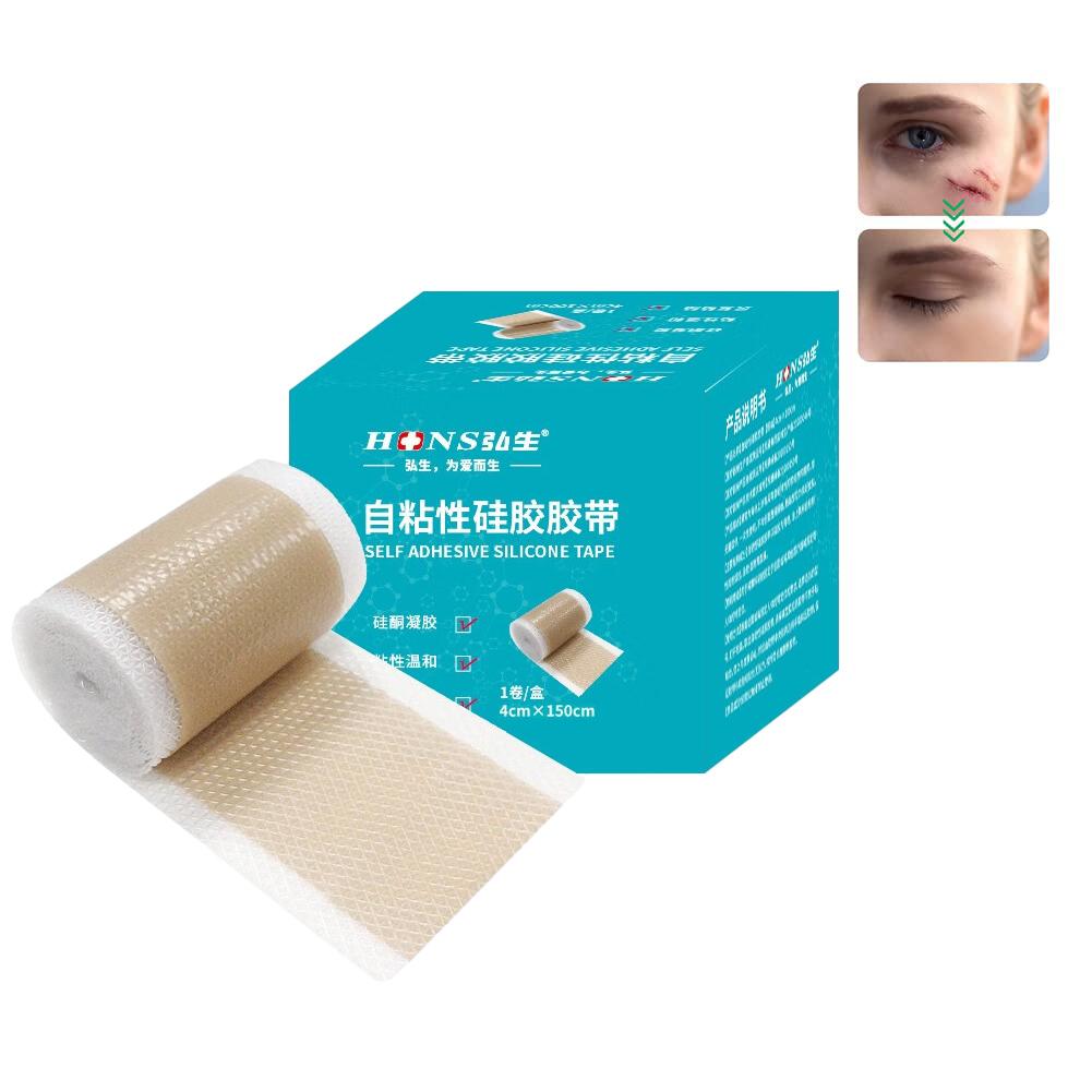 Эффективная хирургическая самоклеящаяся силиконовая гелевая лента для удаления шрамов, терапевтическая заплата для лечения прыщей, травм, ожогов