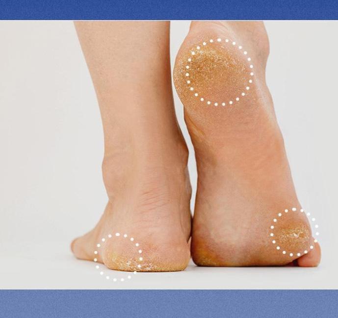 Восстанавливающий и увлажняющий крем для ног с EGF – разглаживает и увлажняет потрескавшиеся пятки.