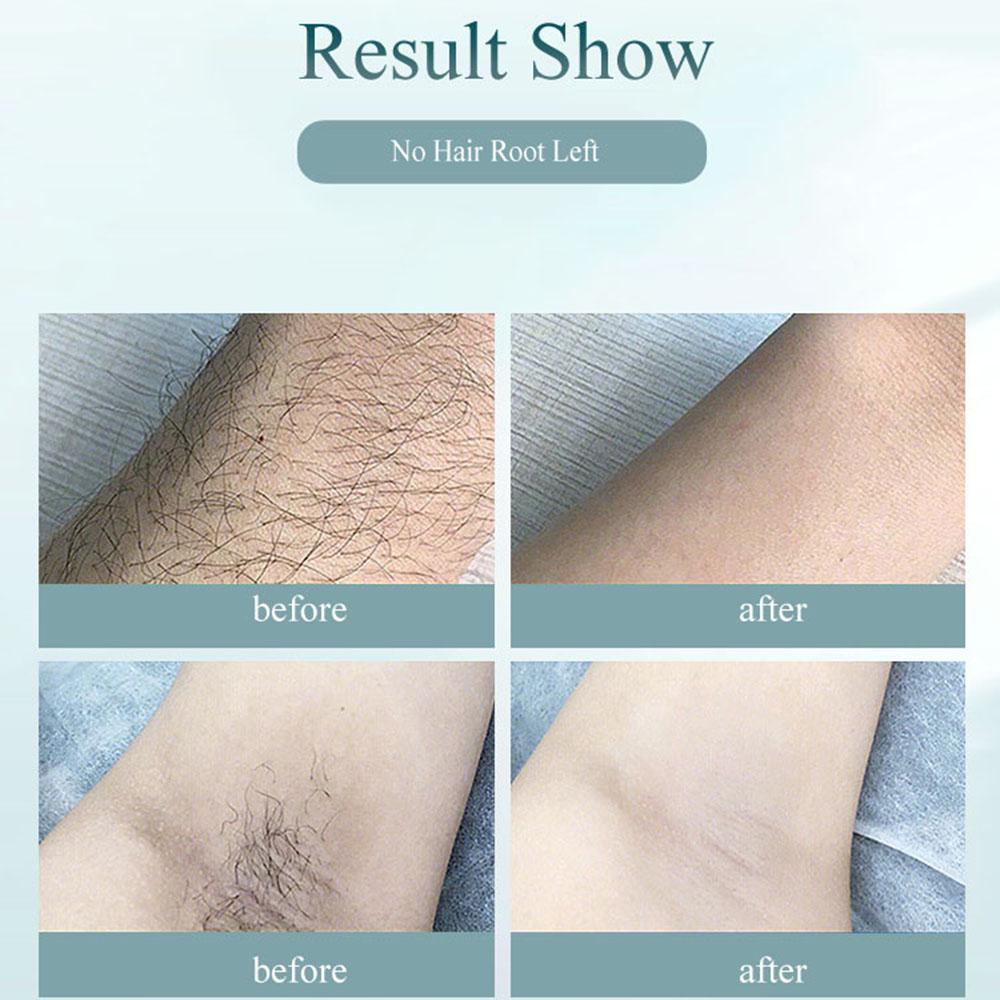 Инструмент для удаления волос Бритва Эпилятор Удалитель волос 900 000 вспышек Перманентный Безболезненный KTY